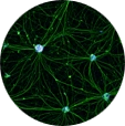 hiPSC-Motor-neurons.webp