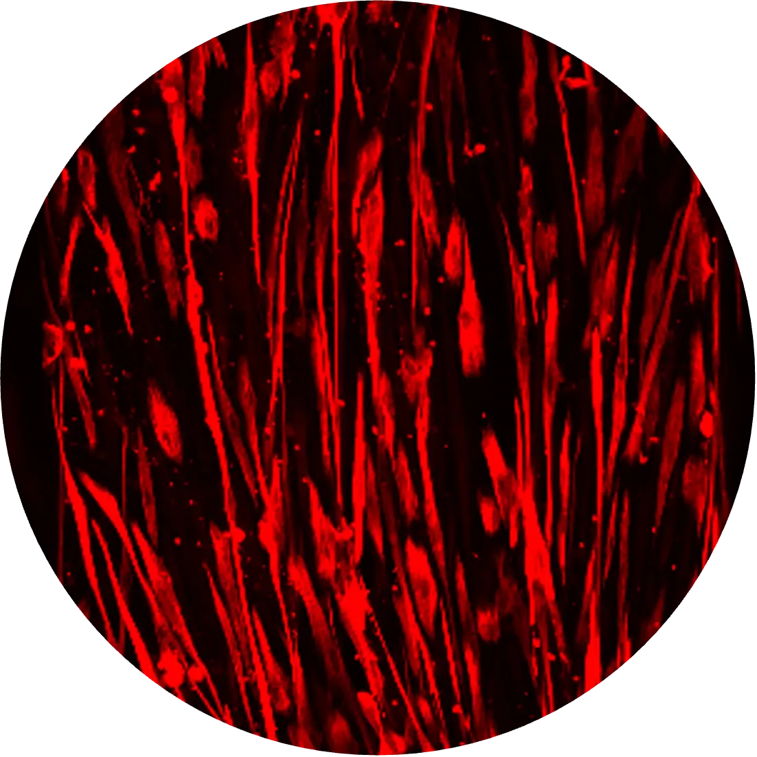 Skeletal-Muscle.webp