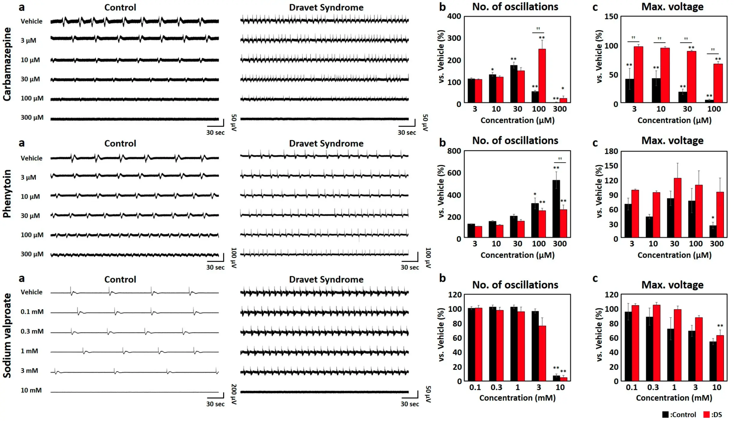 Contraindicated Drug Detection for Dravet Syndrome Using iPSC-Derived Brain Organoids
